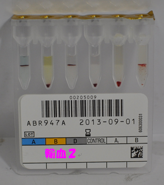 血液型検査用カラム